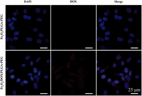 Figure 7. Confocal images of the cellular uptake induced by Fe3O4/DOX/PLGA-PEG in MCF-7 cells: Nucleus were stained with DAPI (blue), DOX (red) image and Merge image.