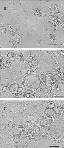 FIGURE 1 Optical micrographs (× 1000 magnification) of caffeine-containing niosomes prepared by film hydration method. Niosomes were composed of (a) Span 20/CHOL/CTAB, (b) Span 60/CHOL, and (c) Span 40/CHOL. Scale bar = 10 μ m.