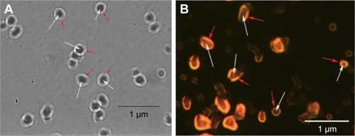 Figure 2 Photograph under white light (A) and fluorescence photograph under 415 nm light excitation (B) of the CNT nanocapsules by microscope at 1,000× amplification. Red arrows represent pheophorbide in the outer shell and white arrows represent CNT in the inner core of the nanocapsules.Abbreviation: CNT, cobra neurotoxin.