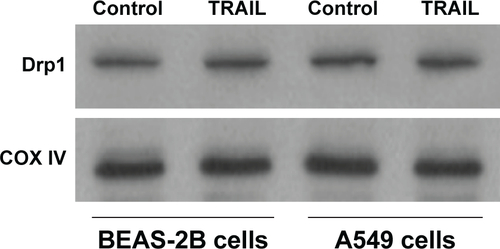 Figure S4 BEAS-2B cells or A549 cells were treated with 20 ng/mL TRAIL for 12 h, and mitochondrial recruitment of Drp1 was assessed by immunoblotting analysis.Abbreviations: Drp1, dynamin-related protein 1; TRAIL, tumor necrosis factor-related apoptosis-inducing ligand.