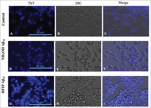 Figure 3. Staining of amyloid proteins present on S. cerevisiae cell walls by thioflavin T. First row (A–C) shows untreated S. cerevisiae cells in presence of ThT in comparison with cells treated with 5 μM NH4OH (D–F) and HFIP (G–I) prepared Aβ42 for 24 h in H2O. ThT staining comparison of untreated (control), NH4OH and HFIP pretreated cells are shown in panels A, D and G respectively. The HFIP pretreatment of Aβ42 results in higher fluorescence intensity and adhesion of peptide to the S. cerevisiae yeast cell wall protein. Scale bar = 50 μm.