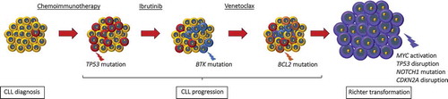 Figure 1. Genetic lesions involved in CLL clonal evolution and in Richter transformation. CLL is characterized by a high degree of molecular heterogeneity. During the clinical history of the disease, CLL may acquire new genetic lesions that may predispose to treatment resistance and, eventually, to Richter transformation. According to this model, at the time of diagnosis the CLL clone is characterized by a preponderance of cells that are sensible to chemotherapy (in yellow), and by only few cells that harbor genetic lesions, such as TP53 abnormalities, predisposing to chemo-refractoriness (in red). At the time of refractoriness to CIT, the CLL clone is mainly composed by cells (in red) that were not cleared by the previous chemotherapy because they harbor genetic lesions that confer refractoriness to CIT. Subsequent lines of treatment include BCRi (ibrutinib targeting BTK and idelalisib targeting PI3Kδ) and the BCL2i venetoclax. Despite the high efficacy of these drugs, a fraction of patients fails to respond over time. The mechanisms of refractoriness to ibrutinib and to venetoclax have been identified, at least to a certain extent. In particular, mutations of the BTK binding domain of ibrutinib, as exemplified in the cells colored in blue, and mutations of the BCL2 binding site of venetoclax, as exemplified in the cells colored in orange, may cause resistance to ibrutinib and to venetoclax, respectively. In addition, at every time point of the CLL clinical history, specific genetic abnormalities (in purple) involving the c-MYC, TP53, NOTCH1 and CDKN2A genes may predispose or lead to Richter transformation, represented by the histologic evolution of CLL to an aggressive B-cell lymphoma.
