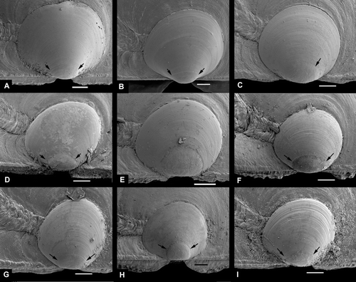 Figure 13.  Larval right valves. Scale lines 50 µm. Arrows indicate demarcation of prodissoconch 1. The scale line is valid for length only; the height may differ slightly because of tilt. (A) Pseudamussium sulcatum, western Norway, Korsfjord, depth 260–250 m (SMNH 20130). (B) Pseudamussium peslutrae, BIOICE#2393, off southwestern Iceland (SMNH 55502). (C) Chlamys islandica, 55503, BIOICE#2537, off northwestern Iceland (SMNH 55503). (D) Aequipecten opercularis, Italy, Sicily, Brucoli, depth 20 m (SMNH 56412). (E) Mimachlamys varia, Sweden, Bohuslän, Koster area, depth 1–2 m (SMNH 20569). Prodissoconch 1 too corroded to indicate. (F) Talochlamys pusio, western Norway, Korsfjord, depth 276–256 m (SMNH 55505). (G) Palliolum striatum, western Norway, Korsfjord, depth 300–200 m (SMNH 19999). (H) Palliolum tigerinum, western Norway, Raunefjord, depth 65–70 m (SMNH 20064). (I) Palliolum incomparabile, Sweden, Bohuslän, Koster area, depth 35 m (SMNH 55523).