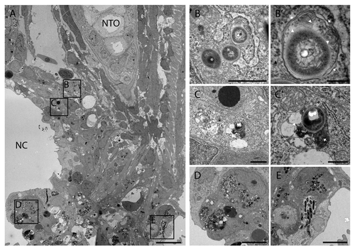 Figure 7. TEM images of tail fin of zebrafish larva infected with M. marinum. (A) Overview image of a granuloma with necrotic center (NC) in the tail fin at 5 dpi. The tail fin is oriented anterior to the top and ventral to the left and the position of the notochord (NTO) is indicated. (B) Higher magnification of the region indicated in (A), showing part of a macrophage with bacteria of which one in a double-membrane autophagic vacuole (black asterisk) and 2 were cytoplasmic (white asterisk). (B’) Higher magnification of bacteria in an initial autophagic vacuole in (B), with arrows indicating the typical double membrane with electron-lucent cleft and arrowheads indicating ribosomes inside (white) and outside (black) of the vacuole. The ruffled appearance of the double membrane could be a fixation or sectioning artifact. (C) Higher magnification of region indicated in (A), showing a single bacterium (asterisk) in a degradative autophagic vacuole. (C’) Higher magnification of the degradative autophagic vacuole containing bacteria in (C), showing a lysosome fused with this vacuole (arrow), which contains partially degraded cytoplasmic material (arrowhead). (D) Higher magnification of indicated region, showing a macrophage with several phagosomal compartments containing bacteria. (E) Higher magnification of indicated region, showing infected epithelial cells. Scale bars: (A) 5 μm, (B and C) 1 μm, (B’) 250 nm, (C’) 500 nm, and (D and E) 10 μm.
