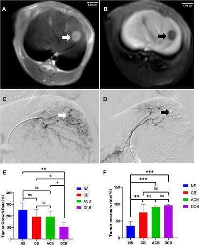 Figure 2 (A) Axial T2WI showing the mass with hyperintensity (white arrow); (B) axial T1WI showing the mass with hypointense (black arrow); (C) arterial angiography of a VX2 liver tumor before embolization; (D) after embolization with DCBs, the tumor staining disappeared; (E) the tumor growth rates of different groups after TACE; (F) The tumor necrosis rates of different groups after TACE. *P<0.05; **P<0.01; ***P<0.001.