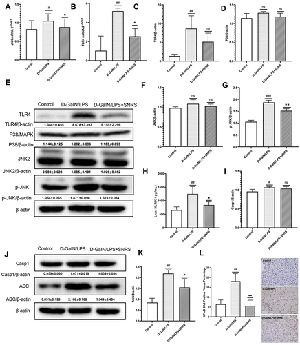 Figure 5 Effects of SNRS on inflammatory signaling pathways. Transcript levels of JNK (A) and TLR4 (B) were detected by RT-PCR. (C) Protein expression of TLR4; (D) Protein expression of p38; (E) Western blotting protein bands of TLR4, P38, JNK2, and P-JNK; (F) Protein expression of JNK2; (G) Protein expression of p-JNK2; (H) NLRP3 levels of liver tissue were determined by ELISA; (I) Protein expression of Casp1; (J) Western blotting protein bands of Casp1 and ASC; (K) Protein expression of ASC; (L) immunohistochemical detection of protein expression of NF-κB. #Model group compared with control group, #P<0.05, ##P<0.01, ###P<0.001. *SNRS group compared with model group, *P<0.05, **P<0.01.