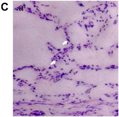 Figure 4 Axonal regeneration and remyelination of transplanted cells in injured spinal cord.Notes: (A) Spinal cord transection and transplantation. Scale bar =0.5 cm. (B) Gross morphology and cavity formation of spinal cord tissue. (C) H&E staining of Group 1 (a), Group 2 (b), Group 3 (c), and Group 4 (d). Arrows: infiltrated cells in spinal cord. Scale bar =100 μm.Abbreviation: H&E, hematoxylin–eosin.