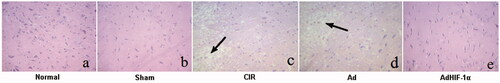 Figure 3. HE staining of rat brain tissues of different groups (×200). a: Normal, b: Sham, c: CIR, d: Ad, e: AdHIF-1α. The nerve cell nucleus is blue and the cytoplasm is red.