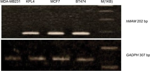 Figure 1 Electrophoresis image of polymerase chain reaction cDNA of hMAM and GAPDH in breast cancer cells.