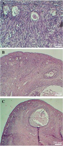 Figure 3. Typical morphologies of degenerated follicles in ovaries of goats fed different levels of dietary energy. Arrows indicated degenerated primary (A), secondary (B) and antral follicles (C), respectively. Scale bars represent 40 (A), 100 (B) and 200 µm(C), respectively.