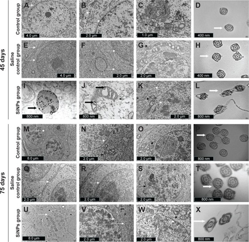 Figure 3 The effects of SiNPs on the ultrastructure of testicular tissue in mice.Notes: (A–D) The ultrastructure of testes in the control group on the 45th day after the first dose. (E–H) The ultrastructure of testes in the saline control group on the 45th day after the first dose. (I and J) SiNPs were observed in the SiNPs group on the 45th day after the first dose. (K and L) SiNPs led to swollen mitochondria and changed the shape of the cross-sections of the sperm tail in the SiNPs group on the 45th day after the first dose. (M–P) The ultrastructure of testes in the control group on the 75th day after the first dose. (Q–T) The ultrastructure of testes in the saline control group on the 75th day after the first dose. (U–X) The ultrastructure of testes in the SiNPs group on the 75th day after the first dose. The swollen mitochondria weren’t observed, and the shape of the cross-sections of the sperm tail were similar to that in the saline control group. The figure shows TEM images of testis. The thin black arrow represents the mitochondria, thin white arrow represents the cell membrane or nuclear membrane, wide white arrow represents the cross sections of the sperms, and wide black arrow represents the SiNPs. The data indicated that SiNPs could accumulate in the testis and damage the mitochondria and sperms.Abbreviations: SiNPs, silica nanoparticles; TEM, transmission electron microscopy.