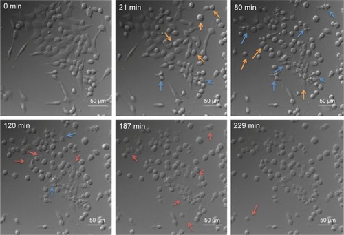 Figure 6 Time-lapse images of HCT-116 cells incubated with PEG–PAG9 show the process of cell death by light irradiation (5.4 mW/cm2).Notes: Orange arrows show loss of cell adhesion, blue arrows show blebbing-like activity, and red arrows show cell swelling.Abbreviations: PEG, polyethylene glycol; PAG, photoacid generator.