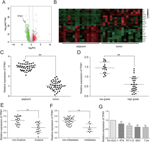 Figure 8. TPM1 was down-regulated in bladder urothelial carcinoma. (A) Volcano plot, R package was used to analyze genes expressed differentially in bladder urothelial carcinoma after analyzing miRNAs expression profiles from 18 paired tissues of TCGA; (B) Heat map. R package showed the expression of the differentially expressed mRNAs. TPM1 was one of the low expressed genes. (C) RT-qPCR demonstrated that TPM1 was low expressed in bladder urothelial carcinoma tissues after comparing 45 tumor tissues with 45 adjacent tissues; (D) RT-qPCR revealed that TPM1 expression in 29 high-grade bladder urothelial cancer tissues was lower than that in 16 low-grade bladder urothelial cancer tissues; (E) RT-qPCR demonstrated that TPM1 production in 20 muscular invasive bladder cancer tissues was lower than that in 25 non-muscle invasive bladder cancer tissues; (F) RT-qPCR showed that TPM1 expression in 10 metastatic bladder cancer tissues was lower than that in 35 non-metastasis bladder cancer tissues; (G) RT-qPCR showed the expression of TPM1 in different BC cell line and normal cell line. **P < 0.01, compared with adjacent tissues, low grade bladder urothelial cancer, non-invasive bladder cancer or non-metastasis bladder cancer. Each RT-qPCR was repeated three times.