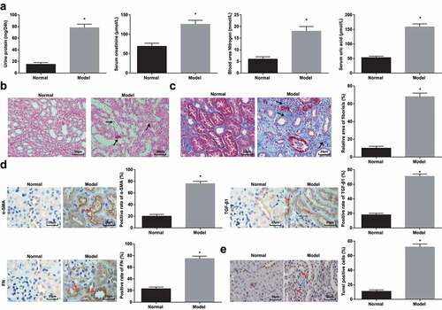 Figure 1. HN induces RIF. (a). 24 h urine protein, Scr, BUN and UA contents in serum of HN rats; (b). H&E staining analyzed pathological damages of renal tissues of HN rats; (c). Masson staining analyzed the degree of fibrosis and RIF index of HN rats; (d). α-SMA, TGF-β1 and FN contents in renal tissues of HN rats; (e). TUNEL staining detected renal cell apoptosis of HN rats. Data were expressed as mean ± standard deviation. The t-test was used for comparison between two groups. * P < 0.05 compared with the normal group.