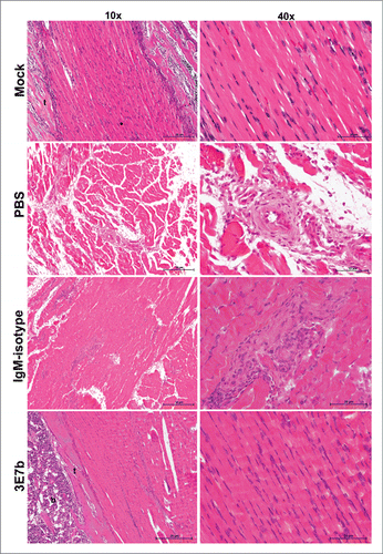 Figure 7. Histological analysis of limb muscles of mice pre-treated with 3E7b. Neonate mice that were mock-infected or pre-treated with PBS, 20 μg of IgM isotype or 3E7b were sacrificed on day 7 p.i. and harvested for their limbs. Limb muscles were paraformaldehyde-fixed, decalcified and processed according to the standard procedures for hematoxylin & eosin staining. Images are viewed and captured under 10× and 40× magnification of BX43 Olympus microscope. Representative images are shown with scale bar of 20 μm. b, bone; t, tendon.