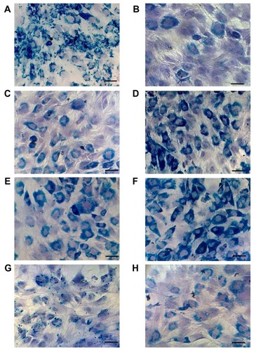 Figure 6 Microscopic observation of Prussian Blue-stained rat bone marrow mesenchymal stem cells labeled with (A) dopamine-maghemite nanoparticles Run I/3, (B) hyaluronate-maghemite nanoparticles Run II/1 and (C) Run II/3, dopamine-hyaluronate-maghemite nanoparticles (D) Run IIIC/1, (E) Run IIIC/2, and (F) Run IIIC/3, (G) Endorem® (Guerbet, Roissy, France), and (H) neat maghemite.Notes: Cell nuclei are counterstained with hematoxylin. Scale bar 25 μm.