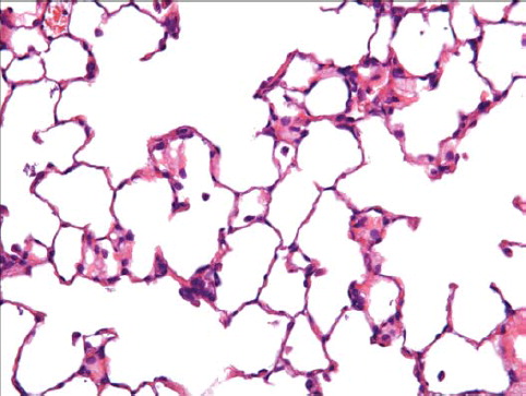 FIG. 14  Histopathological photo of lung from a group 2 rat exposed to chrysotile alone (40× magnification). A few macrophages are seen.
