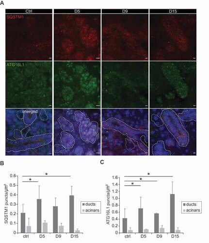 Figure 5. SG ligation-induced tissue regeneration increases autophagy activity. (A) The immunocytochemistry preparations described in Figure 4B were also cut in 5-µm thick sections and label with anti-ATG16L1 and anti-SQSTM1 antibodies. Z-stacks of images separated by 0.2 µm were collected, deconvolved and analyzed as described in Material and Methods. A representative single Z-projection is shown. Nuclei are stained with Hoechst. Ducts are delimitated by white dash-lines. Scale bars: 10 μm. (B,C) Quantification of either SQSTM1 (B) or ATG16L1 (C) puncta number in either duct regions or acinar cell areas (µm2), in the experiment shown in Figure 5A. Bars represent the mean numbers ±SD counted at least in 5 randomly selected sections per SGs. Three different control and ligated SGs were analyzed. Asterisks annotate significant differences of p < 0.05.