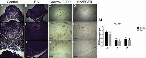 Figure 6. Photomicrographs of the transverse sections of the mice utero-placental units on gestation day (GD) 12.5 from control (a, e, i, c, g, k) and RA treated (b, f, j, d, h, l) groups. (a, e, i) Histology of the developed utero-placental unit from the control group showing, reduction of the thickness of decidual basalis (DB), while the thickness of junctional zone (JZ) and labyrinth zone (LB) is increased comparing to the previous stage (GD10.5). (e) a magnified part of the decidual basalis and junctional zone. (I) a magnified part of labyrinth zone. (b, f, and j) Showing effect of RA treatment on the utero-placental development, note the placenta is abnormal, with inhibition of the development of the labyrinth zones (white arrows), which is not demarcated from the junctional zone (Hx & E staining). (c, g, and k) illustrate the immunohistochemical localization of EGFR of the utero-placental unit from control group, note EGFR is weakly expressed in decidual basalis and junctional zone, and strongly expressed in the labyrinth zone. (d, h, l) showing the effect of RA on EGFR expression level; note RA induces reduction of EGFR expression level in decidual basalis(DB), junctional zone (JZ), and labyrinth zone (LB). (M) Optical density of EGFR-positive areas in decidual basalis (DB), junctional zone (JZ) and labyrinth zone (LB). Density is expressed as the number of positive areas. *P < 0.05 compared with the control group. Blood sinuses (BS). Scale bar (a–d): 100 µm, (e–l): 50 µm.