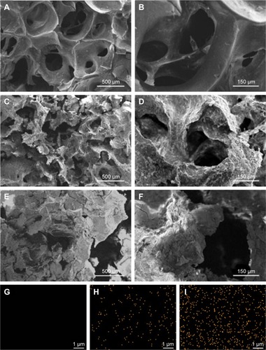 Figure 2 SEM micrographs of surface morphology of GL (A, B), 15nDGC (C, D) and 30nDGC (E, F) scaffolds; EDS mapping of GL (G), 15nDGC (H) and 30nDGC (I), and yellow dots represent Si element, indicating the distribution of nDPB particles into GL.Note: The magnification of (A, C and E) is ×50, the magnification of (B, D and F) is ×200, the magnification of (G, H and I) is ×10,000.Abbreviations: EDS, energy-dispersive spectrometry; GL, gliadin; nDPB, nanoporous diopside bioglass; SEM, scanning electron microscopy; 15nDGC, DGC scaffolds with 15 wt% nDPB; 30nDGC, DGC scaffolds with 30 wt% nDPB.