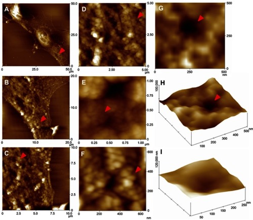 Figure 1 High resolution atomic force microscopy images revealed details of the MCF-7 membrane surface. Images: Show the surface (top-view presentation) which correspond to (A) 50×50µm, (B) 20×20 µm, (C) 10×10 µm, (D) 5×5 µm, (E) 1×1 µm, (F) 0.6×0.6 µm, (G) 0.5×0.5 µm. Three-dimensional images for (H) 0.5×0.5 µm and (I) 0.25×0.25 µm were achieved. Red arrowheads show the zone where the next scan magnification was taking place. Z values: (A) =0–1532.57 nm; (B) =0–616.2 nm; (C) =0–519.13 nm; (D) =0–366.5 nm; (E) =0–78 nm; (F) =0–50 nm and (G) =0–30 nm.