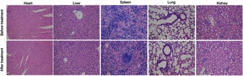 Figure 5 Histology analysis of heart, liver, spleen, lung, and kidney. No pathological change was observed in these tissues; 20 × magnification.