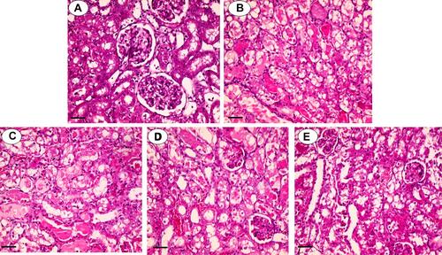 Figure 2 Kidney histopathological alterations in polymyxin E (PolyE)-treated animals. Typical kidney tissue histopathology (A). Tubular necrosis, interstitial inflammation, and atrophy were evident in PolyE-treated (15 mg/kg/day, i.v, seven consecutive days) animals (B). It was found that curcumin administration significantly decreased PolyE-induced renal injury (PolyE + curcumin; (C–E) for 10, 100, and 200 mg/kg of curcumin, respectively). The grades of kidney histopathological alterations are given in Table 2.
