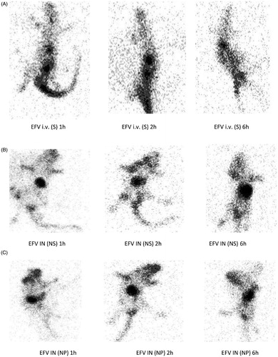 Figure 8. Gamma scintigraphy images of rats showing the presence of radioactivity post-administration of intravenous efavirenz solution [EFV i.v (S)], intranasal efavirenz solution [IN EFV (S)] and intranasal efavirenz nanoparticles (IN EFV-NPs). (A) EFV-i.v.(S), (B) EFV IN (S) and (C) IN EFV-NPs.