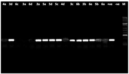 Figure 3. Agarose gel electrophoresis showing the effect of the tested compounds on the nucleic acid of P. aeruginosa. From right to left: lane 1marker (M), lane 2 (negative control), lane 3 (positive control) lane 4 to 19 (fungal DNA treated with the synthetic compounds.