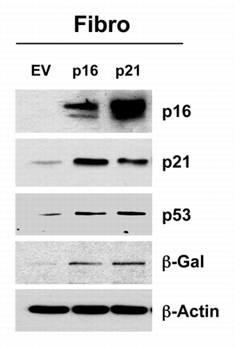 Figure 9. Generating stable fibroblast cell lines, which constitutively express p16(INK4A) and p21(WAF1/CIP1). hTERT-BJ1 fibroblasts were transduced with lenti-viral vectors encoding p16(INK4A) and p21(WAF1/CIP1) and then selected for puromycin-resistance. Control fibroblasts transduced with the empty vector (EV; Lv-105) were produced in parallel. Then, these stable cell lines were subjected to biochemical analysis. Note that after 6 d of culture, the overexpression of markers of cell cycle arrest and senescence [p16(INK4A, p21(WAF1/CIP1), p53 and β-galactosidase] is observed. Blotting with β-actin is shown as a control for equal protein loading.