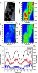 Figure 9 cHA microspheres implanted for 6 months in rat calvaria (region 1). (A) Optical image and (B–D) Ca, Zn and P SR-µXRF elemental mapping; (E) Mass fraction profile of Ca, P and Zn along channel 55 (dash lines).Notes: Dash lines: vertical channel 55.Abbreviations: cHA, carbonated hydroxyapatite; SR-µXRF, Synchrotron radiation-based X-ray microfluorescence.