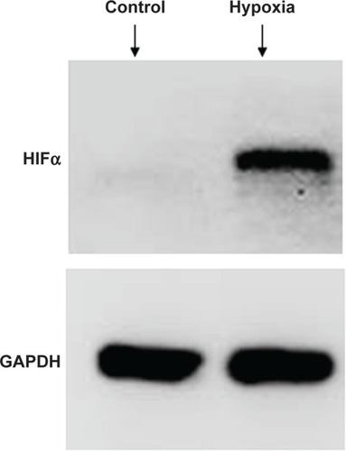 Figure 1 Expression of HIFα in A549 cells detected by Western blot analysis.