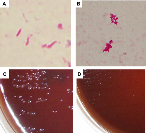 Figure 2 Bacterial morphology and colonies. (A) Morphology of H. pylori growth in BHI broth without disulfiram, (B) morphology of H. pylori with 1μg of disulfiram. After cultivation in broth, bacteria were inoculated on BHI agar. (C) Colony of H. pylori transferred from BHI broth without disulfiram, (D) colony of H. pylori transferred from BHI broth with 1μg of disulfiram.