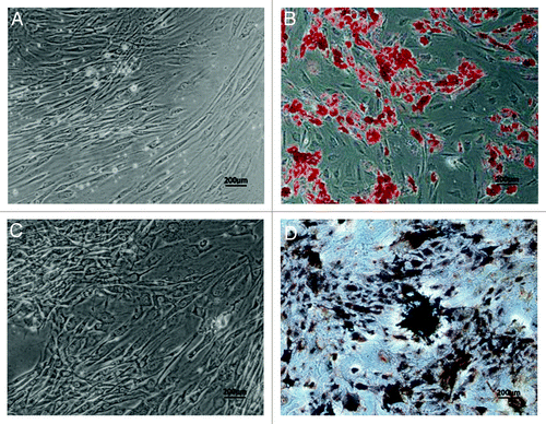 Figure 3. Adipogenic and osteogenic differentiation of human ADSCs in vitro. Human ADSCs at passage 2 were cultured in the induction medium for two weeks for adipogenic differentiation, or for three weeks for osteogenic differentiation. (A) Adherent ADSCs, no staining as a negative control for adipogenic differentiation. (B) Oil red-O staining for induced ADSCs was positive, and presence of lipid droplets demonstrated that ADSCs could differentiate into adipogenic lineage. (C) Adherent ADSCs, no staining as a negative control for osteogenic differentiation. (D) Von Kossa staining showed that a calcified extracellular matrix of induced ADSCs was detected, which confirmed ADSCs could differentiate into osteogenic cells. Scale bars: 200 µm