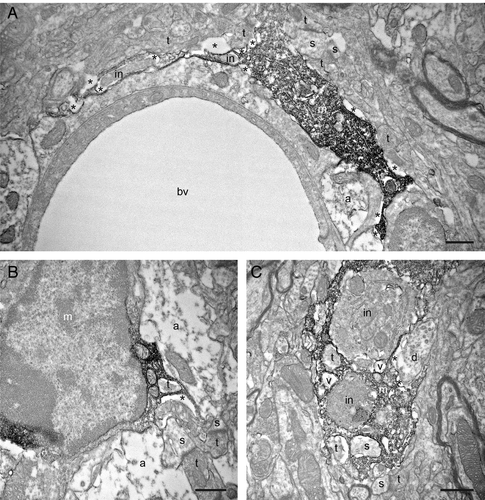 Figure 4. Filopodial protrusions displaying phagocytic inclusions (in) nearby their extremity (A) and closer to the cell body (B). In C, a putative proximal microglial process is containing several cellular inclusions, including two axon terminals (t), a dendritic spine (s) and two vacuoles (v). Note that the engulfed elements are typically surrounded by extracellular space, which suggests their ongoing proteolytic degradation. Other annotations as in Figures 1, 2 and 3. Scale bars: 1μm.
