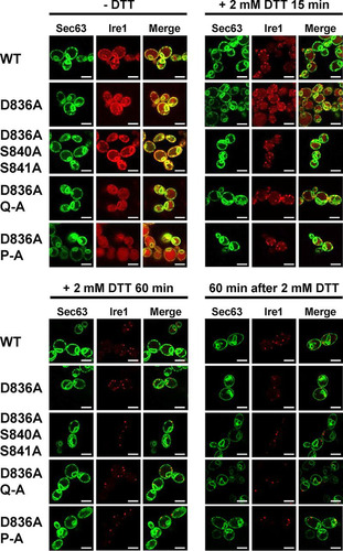 FIG 10 D836 is not required for clustering of Ire1 in vivo. Location of Sec63-GFP and Ire1-mCherry in unstressed cells and cells exposed to 2 mM DTT for 15 min or 1 h or after washout of DTT for 1 h from cells treated with 2 mM DTT for 2 h. Sec63-GFP was expressed from plasmid pJK59 in ire1Δ cells transformed with single-copy LEU2 plasmids derived from pEvA97 that carry the indicated IRE1 alleles. Images covering ∼100 cells were taken, except for the DTT washout experiment, in which ∼20 cells were analyzed. Representative images are shown. Scale bars, 5 μm.