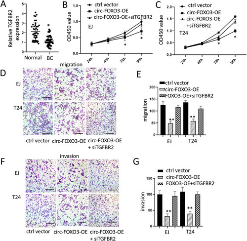 Figure 4 Overexpression of circ-FOXO3 attenuated cell growth, migration, and invasion of bladder cancer cells by regulating TGFBR2. (A) The different mRNA expression levels of TGFBR2 in bladder cancer tissues and adjacent normal tissues (n=49). (B and C) Cell proliferation levels of both EJ and T24 after the transfection of circ-FOXO3 expression vectors or both circ-FOXO3 expression vectors and TGFBR2 siRNA measured by CCK8 assay. (D and E) Cell migration assay of both EJ and T24 after the transfection of circ-FOXO3 expression vectors or both circ-FOXO3 expression vectors and TGFBR2 siRNA (scale bar: 200 μm). (F and G) Cell invasion assay of both EJ and T24 after the transfection of circ-FOXO3 expression vectors both circ-FOXO3 expression vectors and TGFBR2 siRNA (scale bar: 200 μm). *P<0.05 compared with the control group, **P<0.01 compared with the control group.
