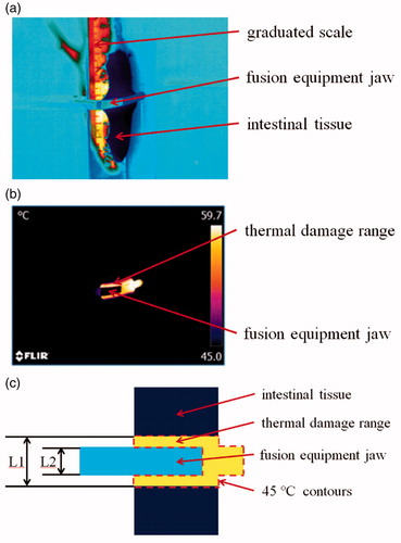 Figure 6. Infrared thermography image. (a) Infrared thermography image before tissue fusion. (b) Infrared thermography image during tissue fusion. (c) Schematic of the infrared thermography image, where L1 is the maximum distance between the 45 °C contours and L2 is the fusion equipment jaw diameter.