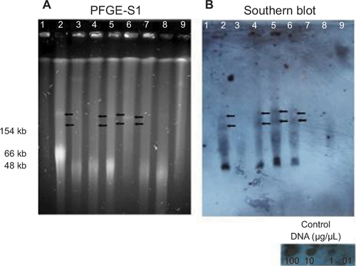 Figure 4 Detection of blaIMP in plasmids of eight P. aeruginosa strains by Southern blot.