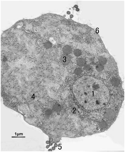 Figure 1. Transmission electron micrographs of untreated T. vaginalis. In untreated-T. vaginalis cell, nucleus (1), rough surfaced endoplasmic reticulum (2), free hydrogenosomes (3), ribosome (4), flagella basal body, (5) and cytoplasmic membrane (6) were observed by TEM in this figure.
