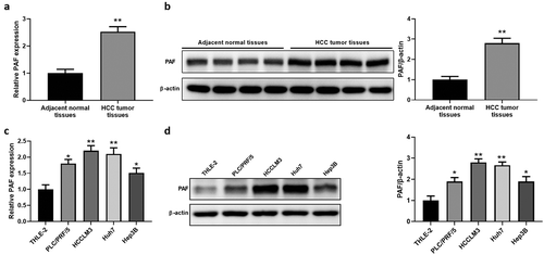 Figure 1. PAF expression is up-regulated in HCC samples and cell lines