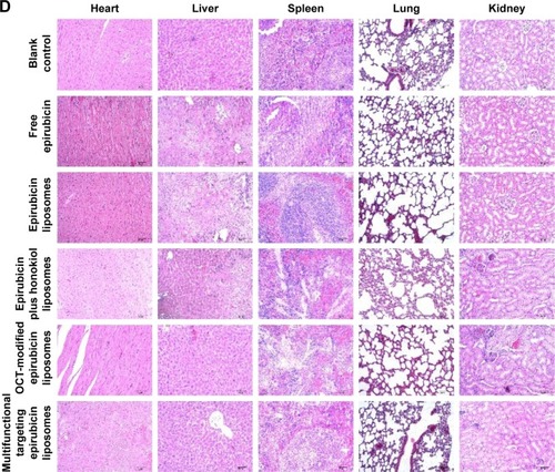 Figure 9 Antitumor effects in LLT cells of xenograft mice after treatments with the varying formulations.Notes: (A) Body weight changes, (B) tumor volume changes, (C) survival rates, (D) H&E staining assay. Magnification ×400. p<0.05; 1, vs blank control; 2, vs free epirubicin; 3, vs epirubicin liposomes.Abbreviations: LLT, Lewis lung tumor; OCT, octreotide.