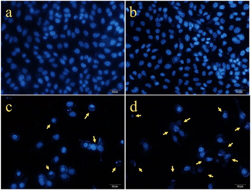 Figure 14. Representative photographs of MCF7 cells treated with GO/NHs (b), free FU (c), and FU-GO/NHs (d) for 48 h and stained with DAPI solution to monitor under fluorescent microscopy. The cells with no treatment considered as a control (a).