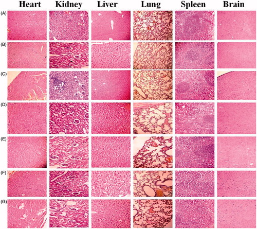 Figure 9. Representative histopathological images of heart, kidney, liver, lung, spleen, and brain of mice treated with (A) control; (B) blank NPs; (C) Dox solution; (D) NPs; (E) Pul NPs; (F) AGn NPs; (G) Pul–AGn NPs.