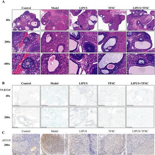 Figure 2. LIPUS and TFSC inhibit ovarian tissue structural disorders and cellular senescence in POF rats. (A) Histopathological changes in the ovaries of rats were observed by HE staining (magnification, 40 ×, 400 μm; 200 ×, 100 μm; 400 ×, 50 μm), n=6, compared with control group, ▲P<.05, ▲▲P<.01; compared with model group, ★P<.05, ★★P<.01. (B) SA-β-Gal staining was used to detect senescence in rat ovaries (magnification, 40 ×, 400 μm; 200 ×, 100 μm), n=6, compared with control group, ▲P<0.05, ▲▲P<0.01; compared with model group, ★P<.05, ★★P<.01. (C) γH2AX staining was used to detect senescence in rat ovaries (magnification, 200 ×, 100 μm), n=6, compared with control group, ▲P<.05, P<.01; compared with model group, ★P<.05, ★★P<.01. LIPUS: low intensity pulsed ultrasound; TFSC: total flavonoids from semen cuscutae; HE: hematoxylin-eosin; SA-β-Gal: senescence associated β-galactosidase.