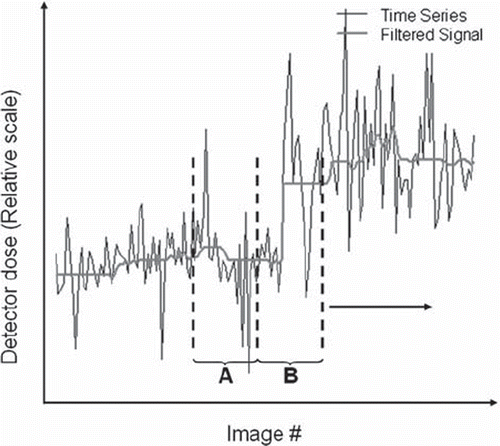 Figure 1. Detector dose time series and median filtered signal with analysis windows A and B. Excerpt from lumbar spine frontal (Fuji XG-1).