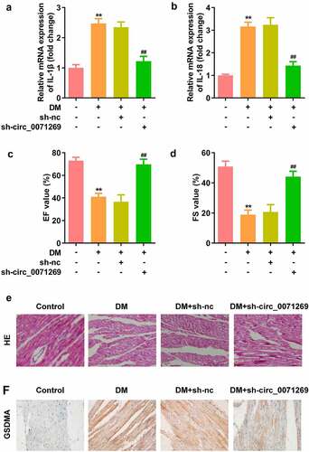 Figure 7. Knockdown of circ_0071269 attenuated cardiac dysfunction of DM mice. a-b: mRNA expression levels of IL-1β and IL-18 in cardiac tissue of the DM mice determined by qRT-PCR. c-d: The echocardiographic data including EF and FS were determined by Echocardiography. e: Images of cardiac tissue stained by HE staining assay. f: The expression of GSDMA obtained from IHC method. All experimental results were obtained by repeating three times. **P < 0.01; ##P < 0.01.