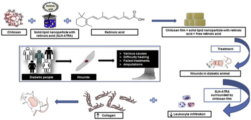 Figure 3. The schematic illustration of the fabrication and application of SLN-ATRA particles in the treatment of diabetic wound. Reproduced with permission [Citation6]. Copyright 2020, Elsevier.