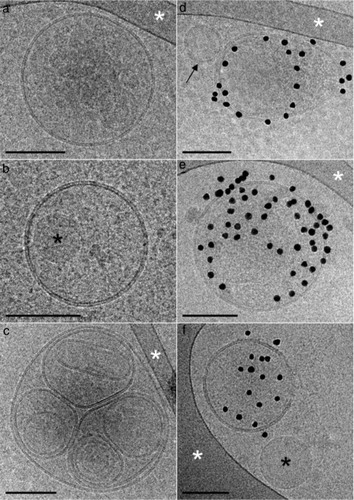 Fig. 2.  Representative cryo-electron microscopy images of lymph extracellular vesicles (EVs). (a through c) EVs devoid of annexin V gold nanoparticles indicate the absence of phosphatidylserine (PS) on their outer membrane surface. (d through f) EVs are labelled by annexin V gold nanoparticles, with the exception of the small unlabelled EVs marked with a black arrow. (b, d) The black asterisks point to circular shapes devoid of a lipid bilayer, which could most likely be lipoproteins. (a, c through e) The white asterisks point to areas of the supporting perforated carbon net. EVs devoid of annexin V gold nanoparticles (g) and EVs labelled by annexin V gold nanoparticles in the lymph of atherosclerotic LDLR-/- mice. Scale bars: 100 nm.