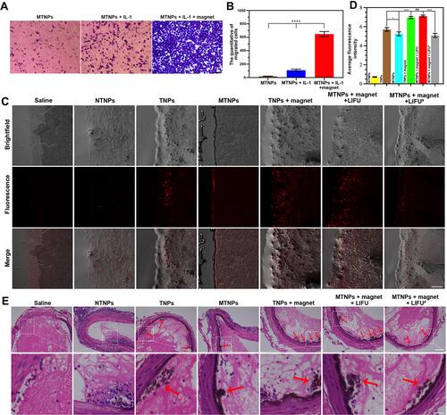 Figure 7 Thrombus-targeting performance of the bionic system. (A) Images of the cell migration assay in the groups treated with MTNPs, MTNPs + IL-1 and MTNPs + IL-1 + magnet (scale bar: 50 μm). (B) Quantitative analysis of migrated cells in the groups treated with MTNPs, MTNPs + IL-1 and MTNPs +IL-1 + magnet (****P<0.0001). (C) CLSM images of frozen thrombus slices incubated with the indicated groups in an extracorporeal circulation device (# the thrombus samples were previously treated with excess free CREKA peptides; scale bar: 100 μm). (D) Average fluorescence intensity analysis of CLSM images in the groups treated with NTNPs, TNPs, MTNPs, TNPs + magnet, MTNPs + magnet + LIFU, and MTNPs + magnet + LIFU# (# the thrombus samples were previously treated with excess free CREKA peptides, *P<0.05, ****P<0.0001, ns = no significance). (E) Pathological images of carotid artery thrombus segments from the indicated groups after H&E staining; the red arrows indicate the NPs (# before treatment, 0.5 mL of hydrated free CREKA peptides (10 mg/mL) injected into the tail vein of rats; scale bar: 200 μm, scale bar for enlarged pathological images: 40 μm).